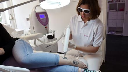 Eine Lasertherapeutin entfernt ein Tattoo.