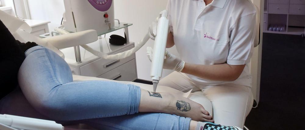 Eine Lasertherapeutin entfernt ein Tattoo.