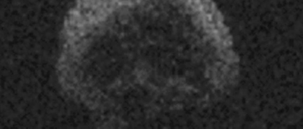 Der Asteroid 2015 TB145 wurde mit Radardaten vom Arecibo Observatorium der National Science Foundation in Puerto Rico detektiert.