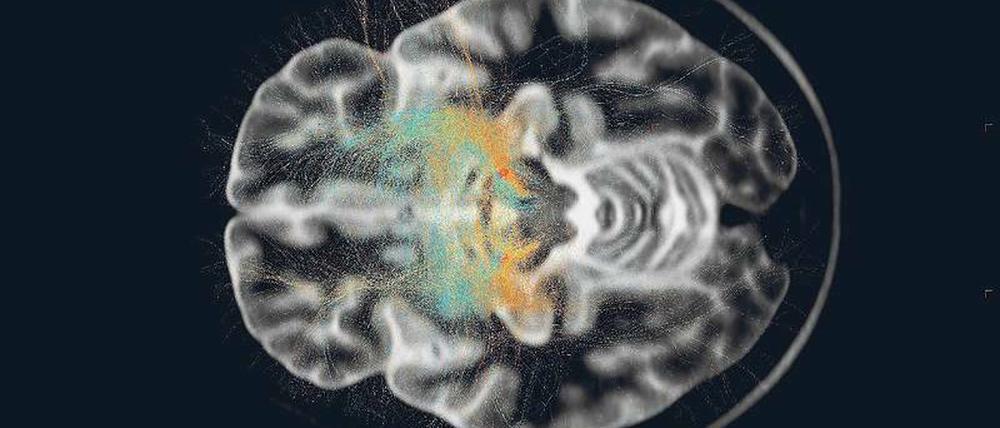 Blick ins menschliche Gehirn: Neurologische und psychiatrische Erkrankungen können viele Ursachen haben. 
