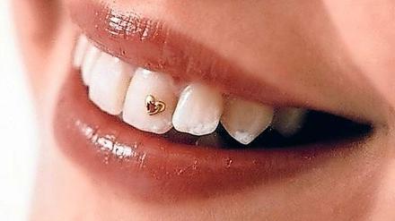 Bling-bling. Kleine Goldfigürchen auf dem Zahn heißen Dazzlers. 