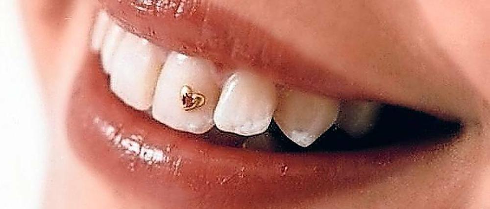 Bling-bling. Kleine Goldfigürchen auf dem Zahn heißen Dazzlers.