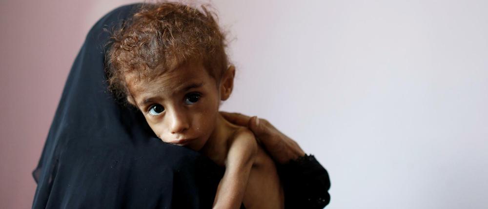 Dramatische Lage. Eine Jemenitin hält in einem Krankenhaus in der Hauptstadt Sanaa einen völlig unterernährten Jungen auf dem Arm.