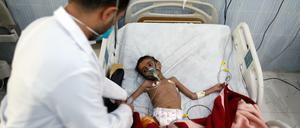 Schon jetzt leiden mehr als acht Millionen Menschen im Jemen unter schwerer Unterversorgung.