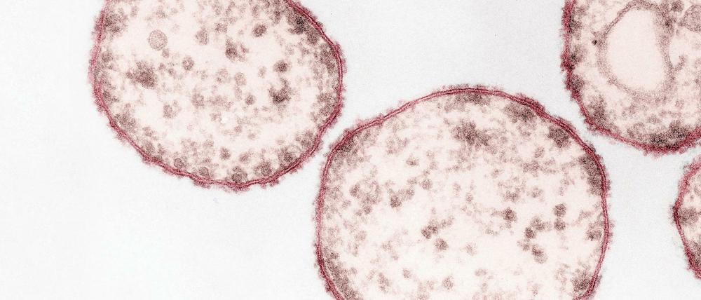 Das Masernvirus (Paramyxoviren) im Ultradünnschnitt.