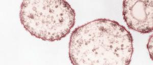 Das Masernvirus (Paramyxoviren) im Ultradünnschnitt. 