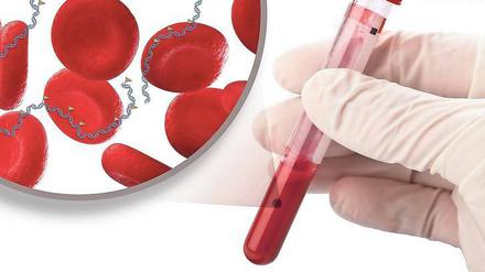 Kleine Moleküle, große Daten. Das Erbgut selbst, aber auch winzige ihm angeheftete Moleküle, sind entscheidend dafür, ob eine Therapie wirkt. Blutentnahmen (im Bild) und Proben aus dem Tumor können die notwendige Information liefern. 