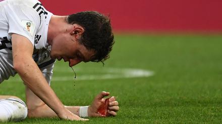 Schmerzhaft. Nicht nur Nationalspieler Sebastian Rudy weiß, wie empfindlich die Nase ist.