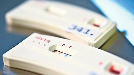 Mit dem Schnelltest sollen sich mehr Menschen trauen, ihren HIV-Status zu diagnostizieren.