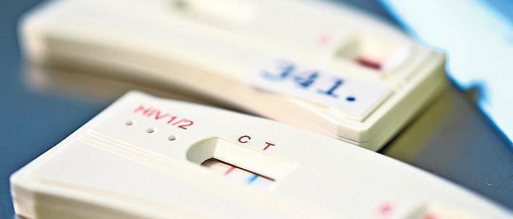 Mit dem Schnelltest sollen sich mehr Menschen trauen, ihren HIV-Status zu diagnostizieren.
