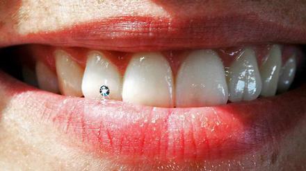 Da kann die Verkäuferin noch so nett lächeln. Mundgeruch ist geschäftsschädigend.