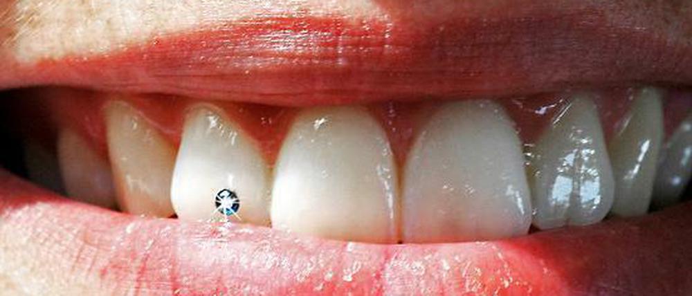 Da kann die Verkäuferin noch so nett lächeln. Mundgeruch ist geschäftsschädigend. 