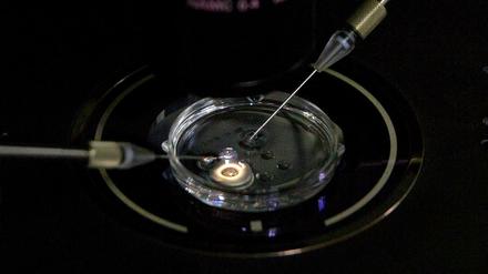 Ein Embryo erhält eine kleine Dosis Cas9-Protein und PCSK9 sgRNA in einem Spermieninjektionsmikroskop in einem Labor in Shenzhen. 