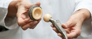 Ein künstliches Hüftgelenk