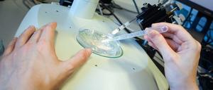 Mit Hilfe der sogenannten Gen-Schere kann Erbgut verändert werden.