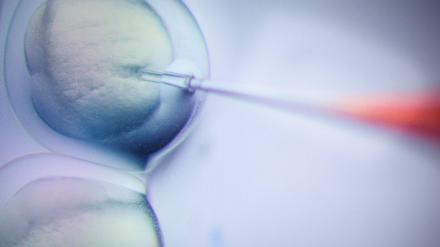 Ein Schritt des CRISPR/Cas9-Verfahrens ist in einem Labor am Max-Delbrück-Centrum für Molekulare Medizin in vielfacher Vergrößerung auf einem Monitor zu sehen.