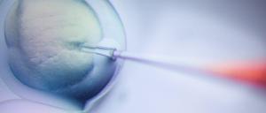 Ein Schritt des CRISPR/Cas9-Verfahrens ist in einem Labor am Max-Delbrück-Centrum für Molekulare Medizin in vielfacher Vergrößerung auf einem Monitor zu sehen.