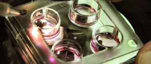 In einem Kinderwunschzentrum werden menschliche Eizellen beurteilt.