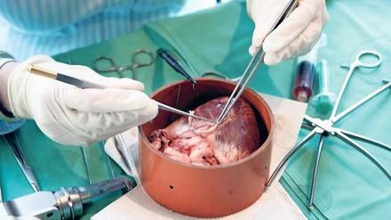 Schwein haben. Für Patienten mit schweren Herzerkrankungen wäre es ein Glück, wenn Schweineherzen nach jahrzehntelanger Forschung endlich als Ersatz für das defekte Pumporgan einsetzbar gemacht werden könnten. 