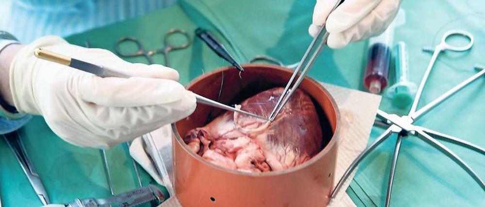 Schwein haben. Für Patienten mit schweren Herzerkrankungen wäre es ein Glück, wenn Schweineherzen nach jahrzehntelanger Forschung endlich als Ersatz für das defekte Pumporgan einsetzbar gemacht werden könnten.