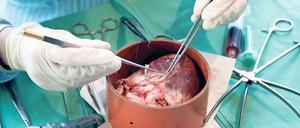 Schwein haben. Für Patienten mit schweren Herzerkrankungen wäre es ein Glück, wenn Schweineherzen nach jahrzehntelanger Forschung endlich als Ersatz für das defekte Pumporgan einsetzbar gemacht werden könnten.