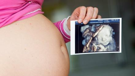 Gentests, die Erbkrankheiten von Kindern anhand von Blutproben der Mutter erkennen können, sollten nicht ohne begleitende Beratungen und Untersuchungen, etwa per Ultraschall, stattfinden, sagen Pränataldiagnostiker.