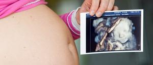 Gentests, die Erbkrankheiten von Kindern anhand von Blutproben der Mutter erkennen können, sollten nicht ohne begleitende Beratungen und Untersuchungen, etwa per Ultraschall, stattfinden, sagen Pränataldiagnostiker.