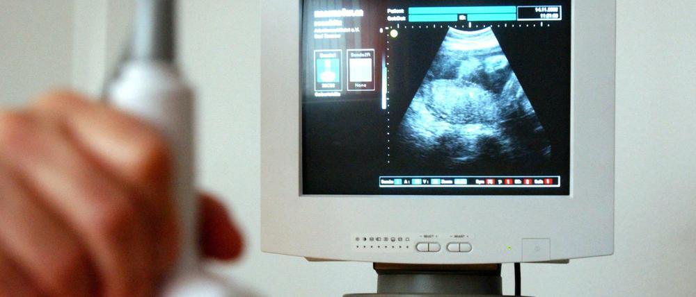 Ultraschalluntersuchung in der Schwangerschaft