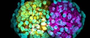 Aus Stammzellen können Forscher frühe Stadien von Embryonen züchten, die sich fast schon wie natürliche Embryonen entwickeln. Was (wie hier) noch von Mausstammzellen stammt, ist wohl bald auch mit menschlichen möglich.