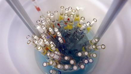 Benutzte Pipetten im Max-Planck-Institut für Infektionsbiologie (Symbolbild)