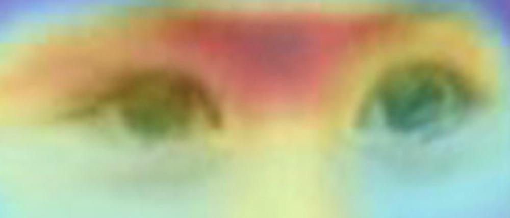 Mit Hilfe solcher Portrait-Aufnahmen kann ein Computerprogramm mit einer gewissen Wahrscheinlichkeit die seltene Erbkrankheit (syndromale, mentale Retardierung vom Typ Bain) dieses Kindes identifizieren. Ausschlaggebend für die Diagnose (orange) waren das kleine Kinn und die Augenpartie.