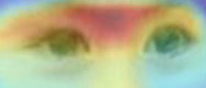 Mit Hilfe solcher Portrait-Aufnahmen kann ein Computerprogramm mit einer gewissen Wahrscheinlichkeit die seltene Erbkrankheit (syndromale, mentale Retardierung vom Typ Bain) dieses Kindes identifizieren. Ausschlaggebend für die Diagnose (orange) waren das kleine Kinn und die Augenpartie. 