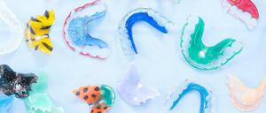 Lose Klammern wie hier im Bild sollen verhindern, dass sich die Zähne nach der Behandlung wieder zurückdrehen