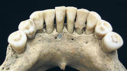 Bluetooth im Kloster: Farbspuren im Zahnstein einer vor 900 Jahren gestorbenen Nonne deuten darauf hin, dass auch Frauen religiöse Bücher abschrieben und verzierten. 