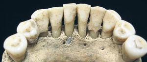 Bluetooth im Kloster: Farbspuren im Zahnstein einer vor 900 Jahren gestorbenen Nonne deuten darauf hin, dass auch Frauen religiöse Bücher abschrieben und verzierten.