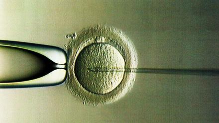 Befruchtung im Labor. Gentests vor der Implantation sind zwar mit Einschränkung erlaubt, müssen bisher aber selber bezahlt werden.