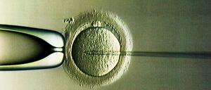 Befruchtung im Labor. Gentests vor der Implantation sind zwar mit Einschränkung erlaubt, müssen bisher aber selber bezahlt werden.
