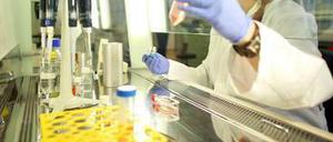 Immer mehr Menschen leiden an Alzheimer- etwa 200.000 Neuerkrankungen gibt es pro Jahr in Deutschland. Etwa ein Prozent von ihnen weist einen Gendefekt auf, der die Krankheit auslöst. Bei diesen Menschen ist der Verlauf recht gut vorhersehbar - das nutzten die Wissenschaftler in ihrer aktuellen Studie. 