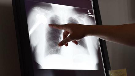 Die allermeisten Ärzte arbeiten korrekt. Aber wenige Mediziner können massive Schäden anrichten.