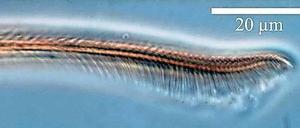 Beinfrisur. Dass Spinnen haarig sind, hat einen Sinn. 