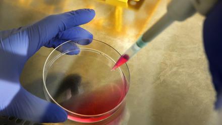 Forschungsergebnisse sind eine Sache, die Umsetzung ins Gesundheitssystem eine andere. Um die Verzahnung dieser Prozesse für "lebende Medikamente" zu fördern stellt die Europäische Kommission jetzt Geld bereit. 