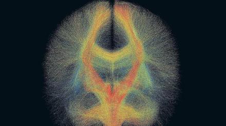 Dem Gehirn kann man nur begrenzt beim Arbeiten zusehen. Forschende nutzen Darstellungen wie diese, um die Therapie für Parkinson zu verbessern. 