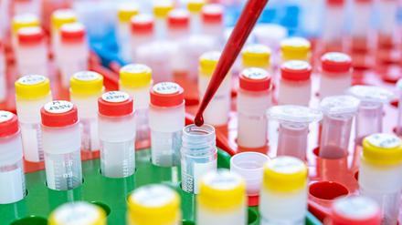 Mit einem neuen Bluttest, entwickelt an der Uniklinik Heidelberg und der Firma HeiScreen, wollen Krebsforscher Brustkrebs künftig besonders schonend diagnostizieren.