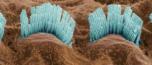 Haarige Sache: Die Büschel (Stereocilien) am Kopf der Haarsinneszellen nehmen das mechanische Signal des Schalls auf und wandeln es um in einen elektrischen Reiz, der an Nervenzellen und das Gehirn weitergeleitet wird. 