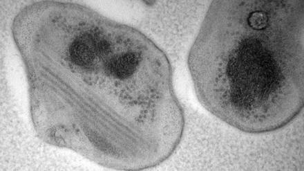 Das Bakterium "Methylocapsa gorgona" (undatierte Aufnahme). Wissenschaftlern ist die Züchtung des Bakteriums gelungen, das allein von der Luft lebt. Das Bakterium könne dabei das besonders klimaschädliche Gas Methan zur Energiegewinnung nutzen, schreiben die Forscher im Fachjournal «PNAS». 