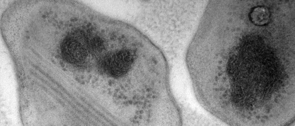 Das Bakterium "Methylocapsa gorgona" (undatierte Aufnahme). Wissenschaftlern ist die Züchtung des Bakteriums gelungen, das allein von der Luft lebt. Das Bakterium könne dabei das besonders klimaschädliche Gas Methan zur Energiegewinnung nutzen, schreiben die Forscher im Fachjournal «PNAS».
