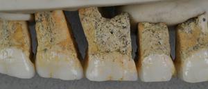 Auch die Zähne von Homo luzonensis haben einen Mix archaischer, Australophitecus-ähnlicher und dem modernen Menschen, Homo sapiens, gleichende Merkmale.