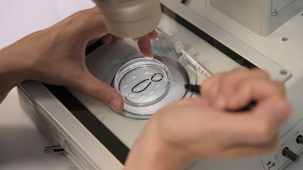 Eizellen werden in einer Kinderwunschpraxis präpariert.