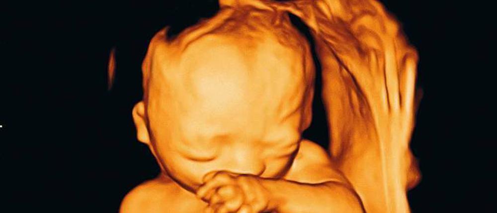 Plastisch. Mit einem 3-D-Ultraschall kann man das Ungeborene erkennen. Aus medizinischer Sicht ist das nicht immer sinnvoll.