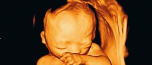 Plastisch. Mit einem 3-D-Ultraschall kann man das Ungeborene erkennen. Aus medizinischer Sicht ist das nicht immer sinnvoll.